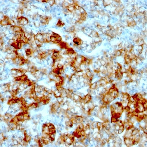 Ksp-Cadherin (Kidney-Specific Cadherin) / CDH16; Clone SPM594 (Concentrate)